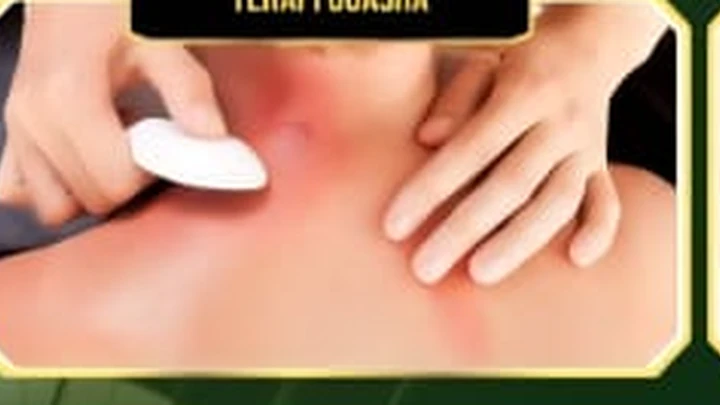 Ilustrasi Therapy Guasha
